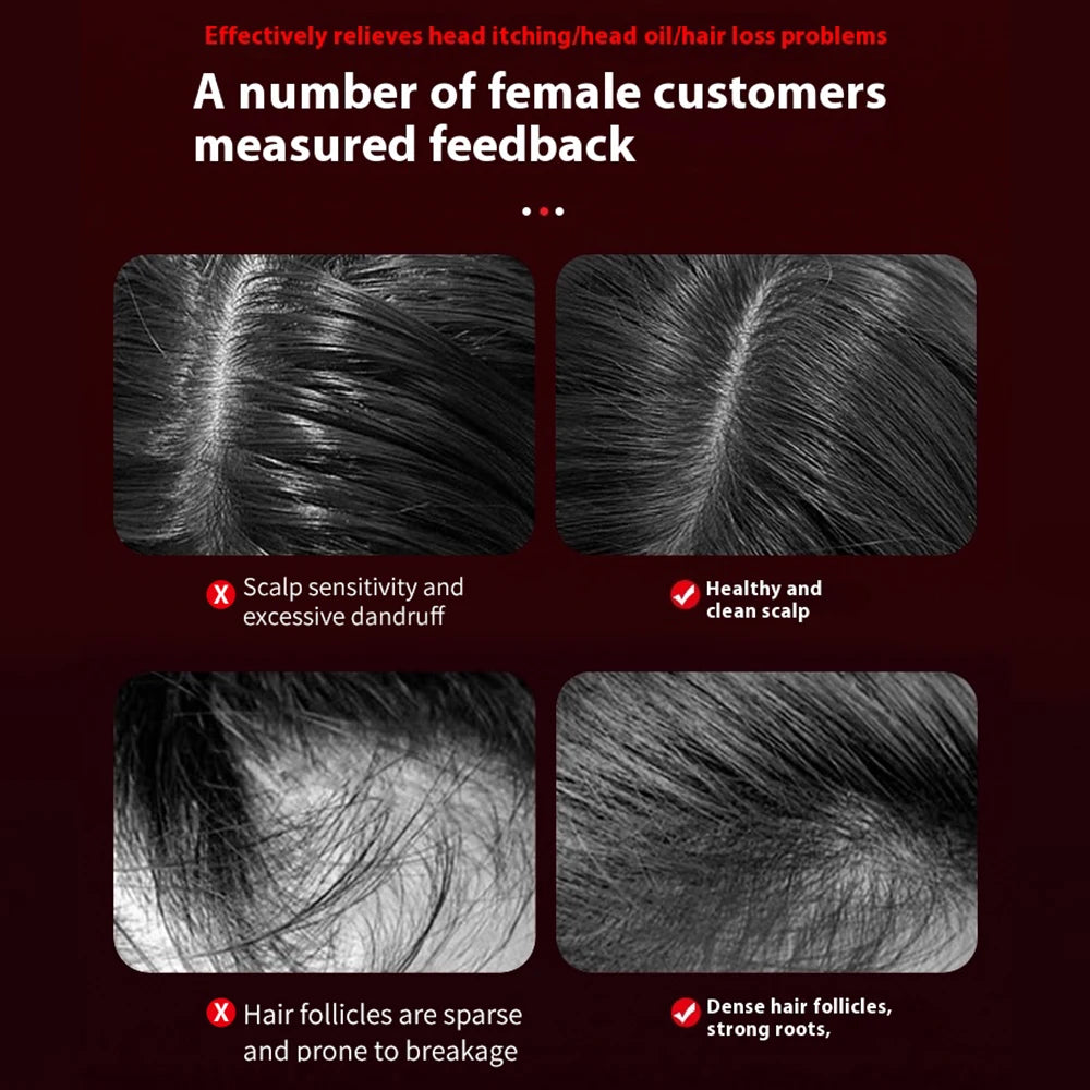 Electric Scalp Massager with Nourishing Oil Infusion