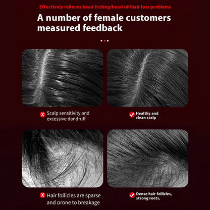 Electric Scalp Massager with Nourishing Oil Infusion