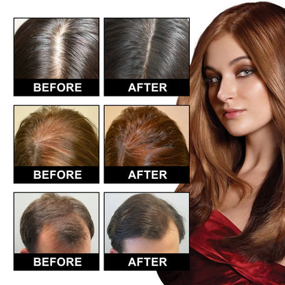 Electric Scalp Massager with Nourishing Oil Infusion